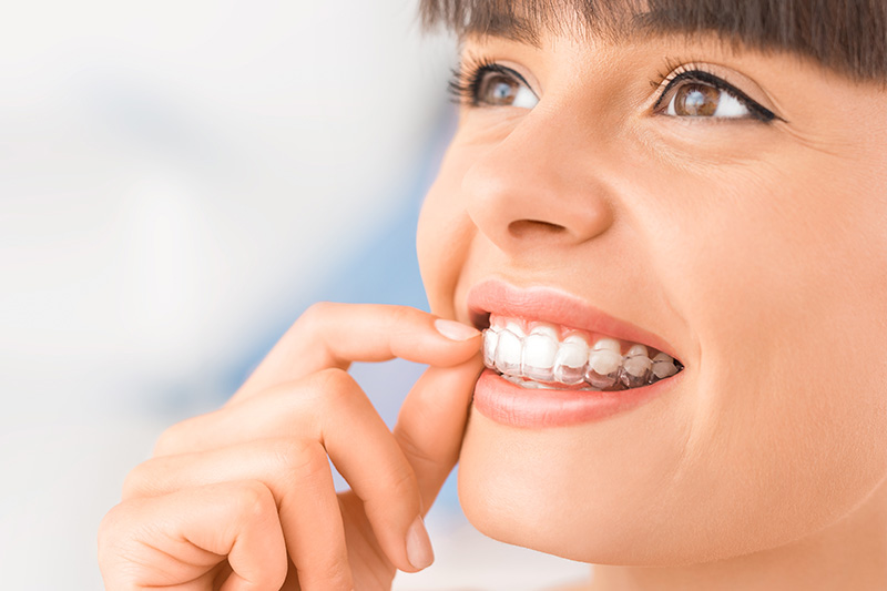 Invisalign in Torrance