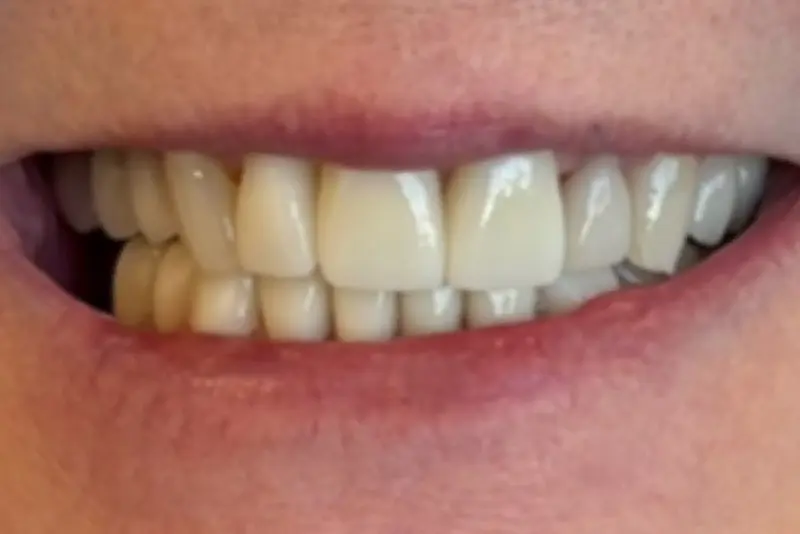 Person showing bright teeth