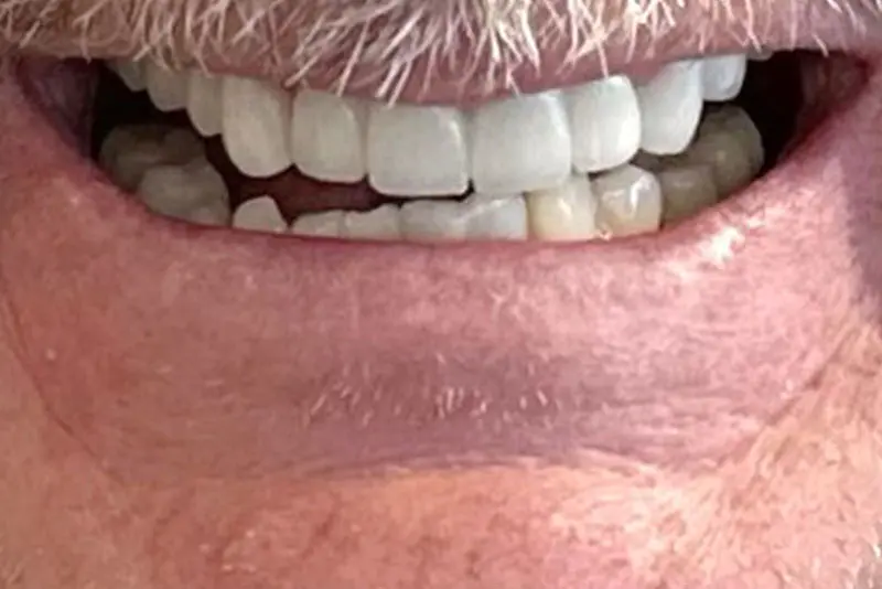 Close-up of a smiling mouth