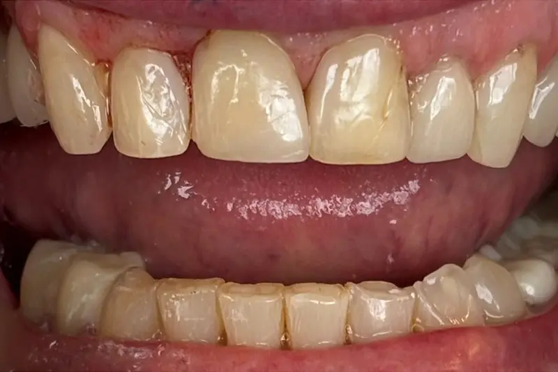 Dental health check-up needed