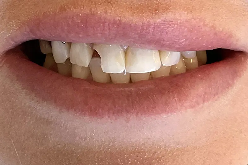 Smiling mouth with visible teeth