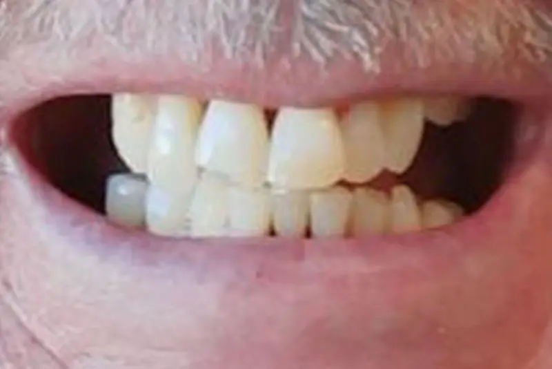 Close-up of a smiling mouth