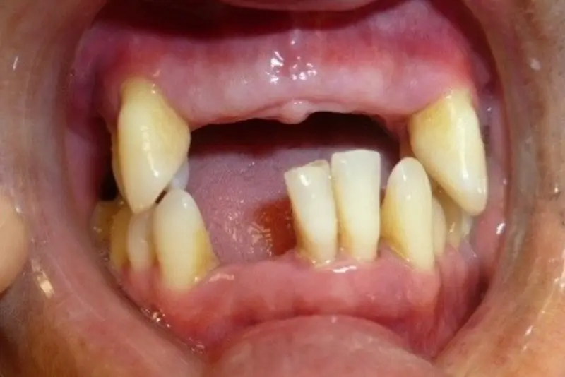 Oral health issues visible