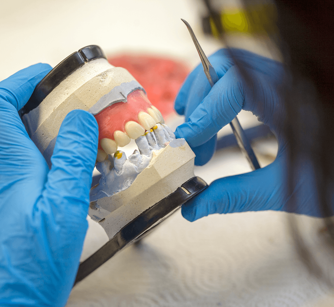 Dentist crafting a set of dentures