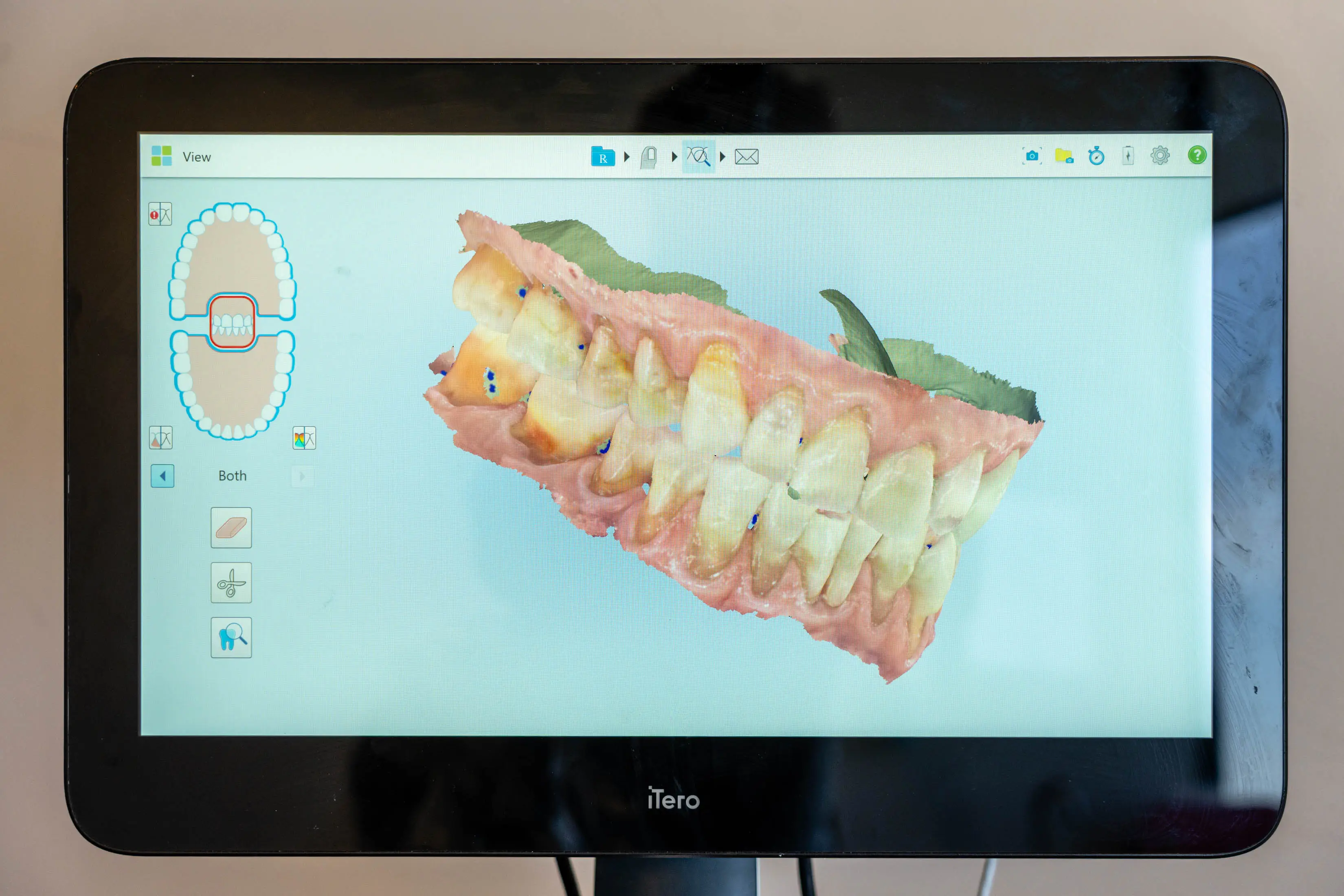 Computer monitor sitting on top of a desk, with a picture of a denture on the screen